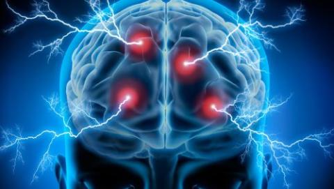 X-ray scan of a brain showing eletrical bolts.