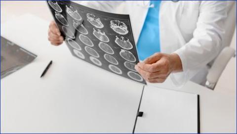 Doctor looking at image of brain Pet scan