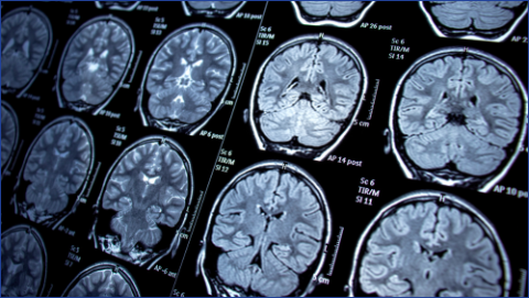 Scans of a person's brain